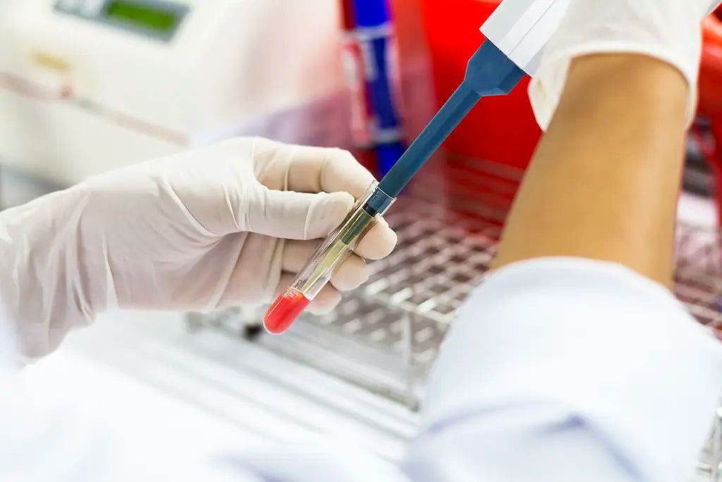 Celiac & Gluten Sensitivity - serum Test