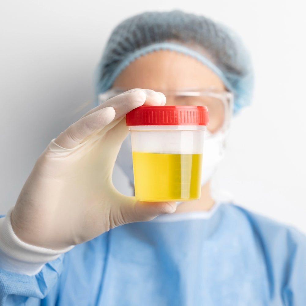 Hormone and Urinary Metabolites Assessment Profile (HuMap)